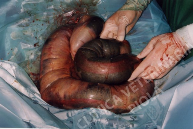 Necrosi da distensione del colon discendente costipato 2